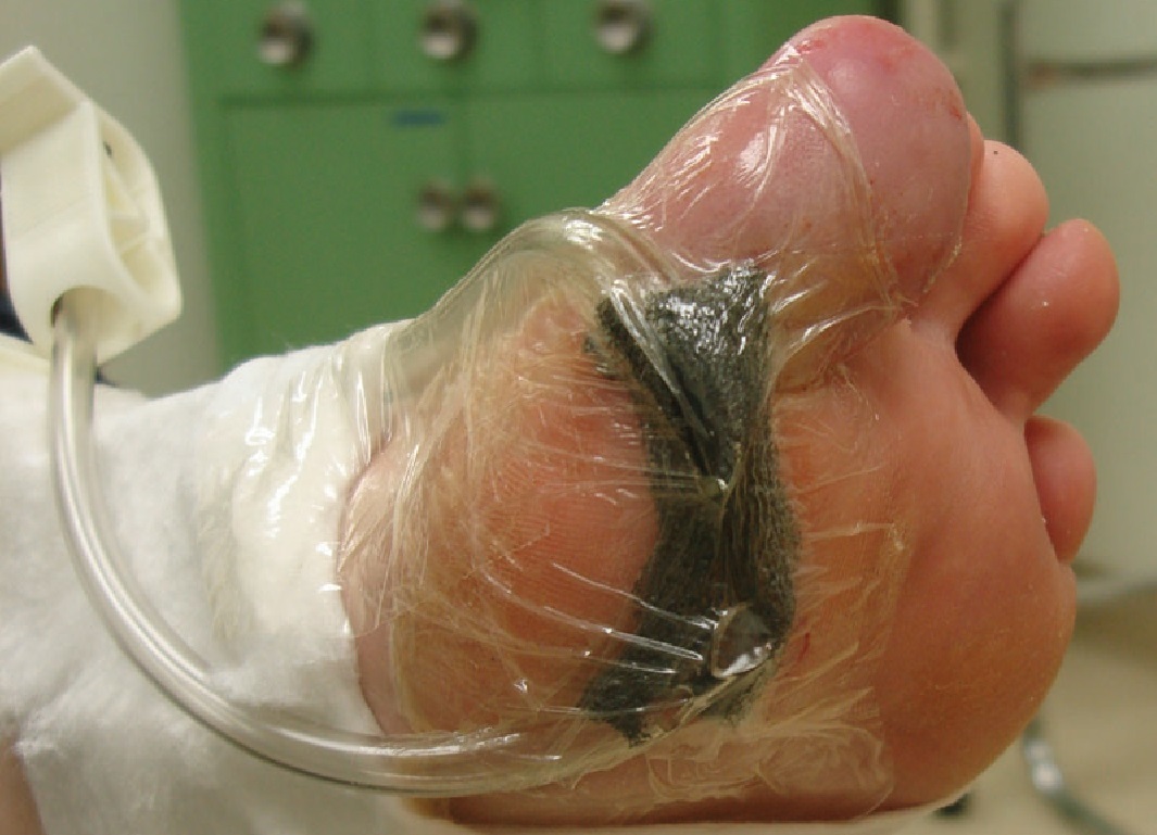 Without fear of new procedures